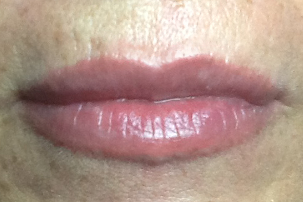 Lippen nach der Pigmentierung