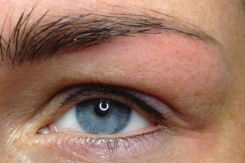 Augen nach der Wimpernkranz-Pigmentierung